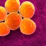 Grazie all’AI è stato progettato un antibiotico efficace contro alcuni batteri resistenti