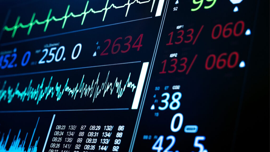 Lanciato un nuovo strumento AI “superumano”: individua patologie cardiache in meno di due secondi